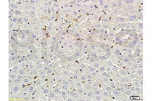 Formalin-fixed and paraffin embedded rat liver labeled with Rabbit Anti-phospho-CD32B(Tyr292) Polyclonal Antibody (ABIN761411) at 1:200 followed by conjugation to the secondary antibody and DAB staining. (FCGR2B antibody  (pTyr292))