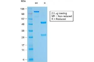 SDS-PAGE Analysis Purified CD79a Mouse Recombinant Monoclonal Antibody (rIGA/764). (Recombinant CD79a antibody)