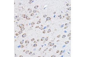Immunohistochemistry of paraffin-embedded mouse brain using PTPN23 Rabbit pAb (ABIN1682396, ABIN3019081, ABIN3019082 and ABIN6220704) at dilution of 1:100 (40x lens). (PTPN23 antibody  (AA 1230-1450))