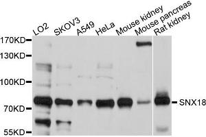 Western blot analysis of extracts of various cell lines, using SNX18 antibody (ABIN5998918) at 1/1000 dilution. (SNX18 antibody)