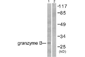 Western blot analysis of extracts from NIH/3T3 cells, using Granzyme B antibody (#C0215).