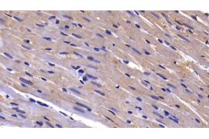 Immunohistochemistry (IHC) image for anti-Caspase 9, Apoptosis-Related Cysteine Peptidase (CASP9) (AA 1-200) antibody (ABIN7432250)