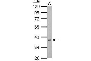 WB Image Sample (50 ug of whole cell lysate) A: Mouse brain 10% SDS PAGE antibody diluted at 1:1000 (CAMK1D antibody)