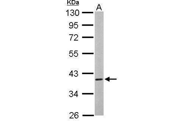 CAMK1D antibody