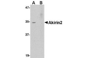 Western blot analysis of Akirin2 in Human Brain tissue lysate with AP30041PU-N Akirin2 antibody at 0.