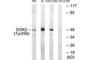 Western Blotting (WB) image for anti-DOK2 (DOK2) (pTyr299) antibody (ABIN2888395) (DOK2 antibody  (pTyr299))