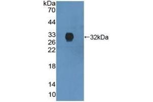 Detection of Recombinant ANXA6, Human using Polyclonal Antibody to Annexin A6 (ANXA6) (ANXA6 antibody  (AA 2-251))