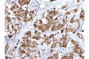 Immunohistochemistry (IHC) image for anti-Fatty Acid Synthase (FASN) (N-Term) antibody (ABIN2856708)