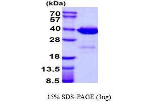 SDS-PAGE (SDS) image for Galectin 4 (LGALS4) (AA 1-323) protein (His tag) (ABIN666903) (GAL4 Protein (AA 1-323) (His tag))