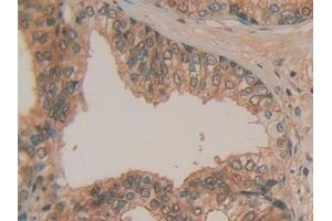 Immunohistochemistry (IHC) image for anti-Hypoxanthine phosphoribosyltransferase 1 (HPRT1) (AA 3-218) antibody (ABIN7432454)