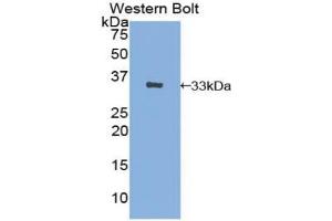 Detection of Recombinant AE1, Human using Polyclonal Antibody to Band 3 (BND3) (Band 3/AE1 antibody  (AA 35-290))