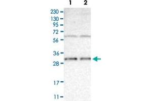 Western Blot analysis of (1) Human RT-4 cell, (2) Human U-251MG sp cell. (BCL10 antibody)