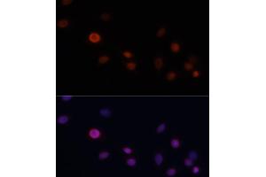 Immunofluorescence (IF) image for anti-Cyclin-Dependent Kinase Inhibitor 1A (p21, Cip1) (CDKN1A) (AA 43-142) antibody (ABIN3022006)