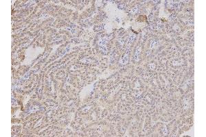 Immunohistochemistry (IHC) image for anti-Thymopoietin (TMPO) antibody (ABIN1875122) (Thymopoietin antibody)