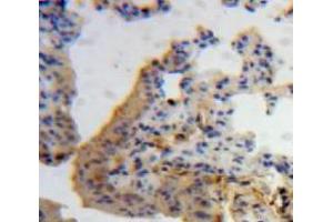 IHC-P analysis of Lung tissue, with DAB staining.