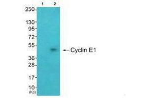 Western blot analysis of extracts from A549 cells (Lane 2), using Cyclin E1 antiobdy. (Cyclin E1 antibody)