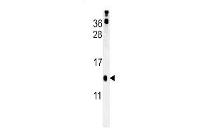 HRASLS3 Antibody (C-term) (ABIN651933 and ABIN2840461) western blot analysis in mouse kidney tissue lysates (15 μg/lane). (PLA2G16 antibody  (C-Term))