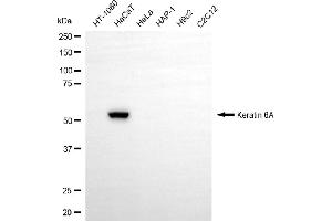 Western blotting analysis using keratin 6A antibody (ABIN7799183).