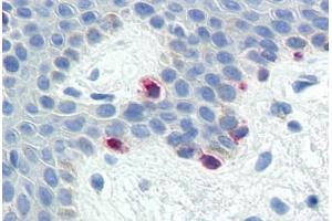 Human Skin, Melanocytes (formalin-fixed, paraffin-embedded) stained with MLANA antibody ABIN573958 at 10 ug/ml followed by biotinylated goat anti-rabbit IgG secondary antibody ABIN481713, alkaline phosphatase-streptavidin and chromogen. (MLANA antibody  (C-Term))