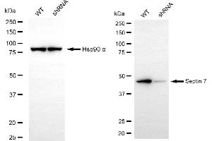 Western blotting analysis using septin 7 antibody (ABIN7800296). (Recombinant Septin 7 antibody)