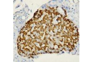 Image no. 1 for anti-Fatty Acid Binding Protein 1, Liver (FABP1) (N-Term) antibody (ABIN1495134) (FABP1 antibody  (N-Term))