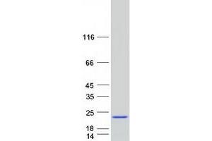 Western Blotting (WB) image for Stathmin 1 (STMN1) (Transcript Variant 1) protein (Myc-DYKDDDDK Tag) (ABIN2732831)