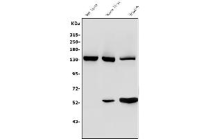 Western blot analysis of Ceruloplasmin/CP using anti-Ceruloplasmin/CP antibody (ABIN3044508).