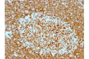 Formalin-fixed, paraffin-embedded human Tonsil stained with CD74 Mouse Monoclonal Antibody (LN-2 + CLIP/813).