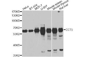 Western blot analysis of extracts of various cell lines, using CCT5 antibody. (CCT5 antibody  (AA 1-270))