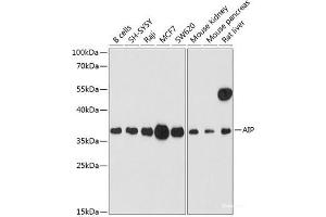 Western blot analysis of extracts of various cell lines using AIP Polyclonal Antibody at dilution of 1:1000. (AIP antibody)