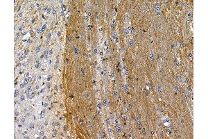 ABIN7094932 and ABIN7098988 at 1/100 staining rat brain tissue by IHC-P.