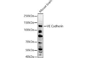 Western blot analysis of extracts of Mouse brain, using VE Cadherin antibody (ABIN3015298, ABIN3015299, ABIN3015300 and ABIN6213971) at 1:500 dilution. (Cadherin 5 antibody  (AA 259-358))