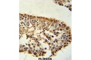 Immunohistochemistry (IHC) image for anti-ERO1-Like beta (ERO1LB) antibody (ABIN3002267) (ERO1LB antibody)