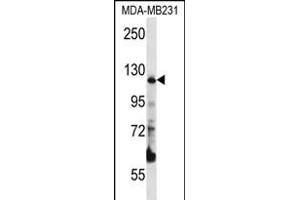 PITRM1 Antibody (Center) (ABIN656324 and ABIN2845623) western blot analysis in MDA-M cell line lysates (35 μg/lane). (PITRM1 antibody  (AA 490-518))