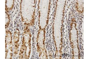 Immunoperoxidase of monoclonal antibody to GABPA on formalin-fixed paraffin-embedded human stomach. (GABPA antibody  (AA 1-100))