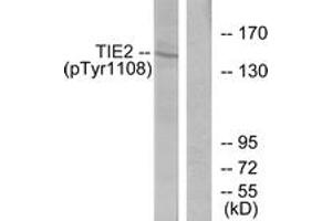 Western blot analysis of extracts from NIH-3T3 cells, using TIE2 (Phospho-Tyr1108) Antibody. (TEK antibody  (pTyr1108))