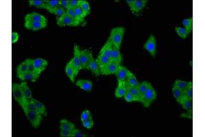 Immunofluorescence staining of HepG2 cells with ABIN7143000 at 1:100, counter-stained with DAPI. (ACCN1 antibody  (AA 197-345))