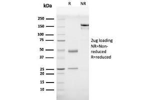 SDS-PAGE Analysis Purified Prohibitin Mouse Monoclonal Antibody (PHB/3230).