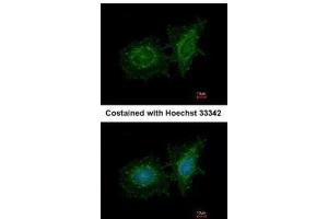 ICC/IF Image Immunofluorescence analysis of methanol-fixed HeLa, using SH3BP1, antibody at 1:200 dilution. (SH3BP1 antibody  (C-Term))