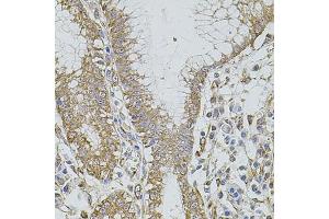 Immunohistochemistry of paraffin-embedded human stomach using HMMR antibody (ABIN5971368) at dilution of 1/100 (40x lens). (HMMR antibody)