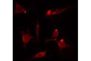 ABIN6274562 staining HepG2 cells by IF/ICC. (YWHAB antibody  (C-Term))