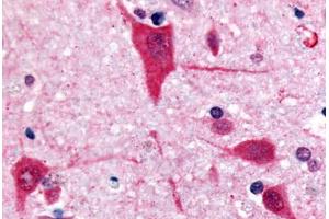 Human Brain, Cortex (formalin-fixed, paraffin-embedded) stained with GPR61 antibody ABIN213359 at 10 ug/ml followed by biotinylated goat anti-rabbit IgG secondary antibody ABIN481713, alkaline phosphatase-streptavidin and chromogen. (GPR61 antibody  (C-Term))