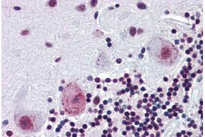 Human Brain, Cerebellum (formalin-fixed, paraffin-embedded) stained with PAX4 antibody ABIN462174 followed by biotinylated goat anti-rabbit IgG secondary antibody ABIN481713, alkaline phosphatase-streptavidin and chromogen. (PAX4 antibody  (AA 166-215))
