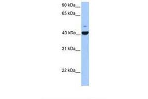 Image no. 1 for anti-FGFR1 Oncogene Partner (FGFR1OP) (AA 81-130) antibody (ABIN6738876)