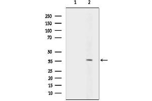 Western blot analysis of lysates from HepG2 cells(heat-shock treatment), using ANKR Antibody.