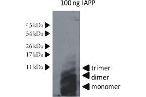 Western Blotting (WB) image for anti-Islet Amyloid Polypeptide (IAPP) antibody (ABIN334637) (Amylin/DAP antibody)