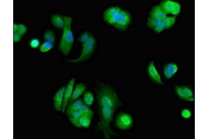 Immunofluorescent analysis of MCF-7 cells using ABIN7152188 at dilution of 1:100 and Alexa Fluor 488-congugated AffiniPure Goat Anti-Rabbit IgG(H+L) (EIF4ENIF1 antibody  (AA 340-630))