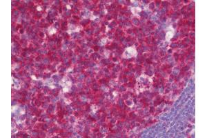 Anti-BCL2L10 / Diva antibody IHC staining of human tonsil. (BCL2L10 antibody  (AA 60-153))