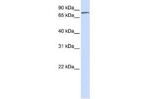 WB Suggested Anti-FERMT1 Antibody Titration:  0. (FERMT1 antibody  (N-Term))