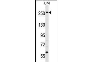 PRKWNK3 Antibody (ABIN391067 and ABIN2841218) western blot analysis in uterus tumor cell line lysates (35 μg/lane). (WNK3 antibody  (C-Term))